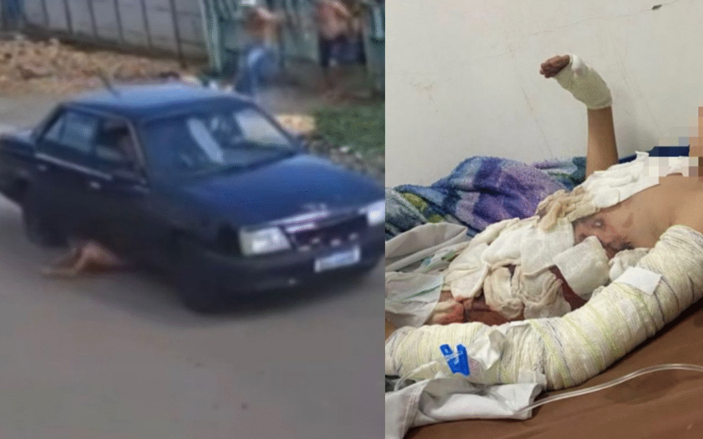 IMAGENS FORTES: Motorista atropela e arrasta por metros criança de 9 anos