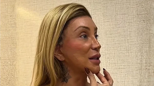 Maya Massafera passa por procedimento estético para afinar o queixo