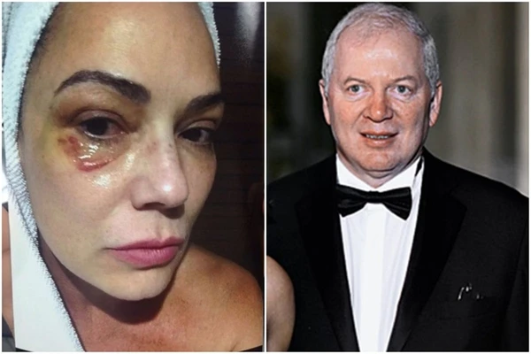 Justiça determina indenização de R$ 150 mil a Luiza Brunet por agressão